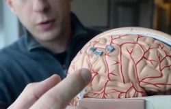 New Brain Implant Begins Human Trials 